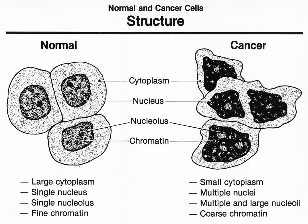 cancer cell structure graphic